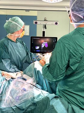 Chirurg Patrick Klauke entfernt das geschädigte Knochengewebe, assistiert von der handgeführten robotischen Präzisionsfräse, um Platz für das Implantat zu schaffen. Das Modell auf dem Bildschirm zeigt das zu entfernende Knochengewebe an. Chirurg Patrick Klauke entfernt das geschädigte Knochengewebe, assistiert von der handgeführten robotischen Präzisionsfräse, um Platz für das Implantat zu schaffen. Das Modell auf dem Bildschirm zeigt das zu entfernende Knochengewebe an.